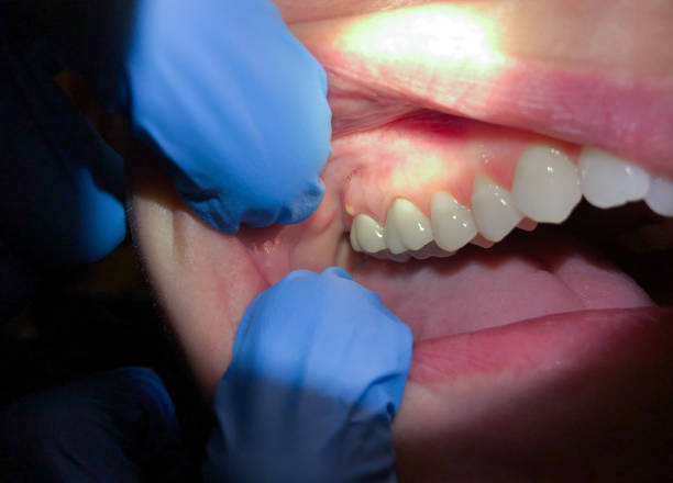 Best Holiday Emergency Dentist in Canton, IL