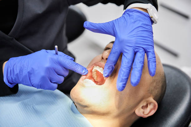 Best Broken or Cracked Tooth Emergency Dentist in Canton, IL